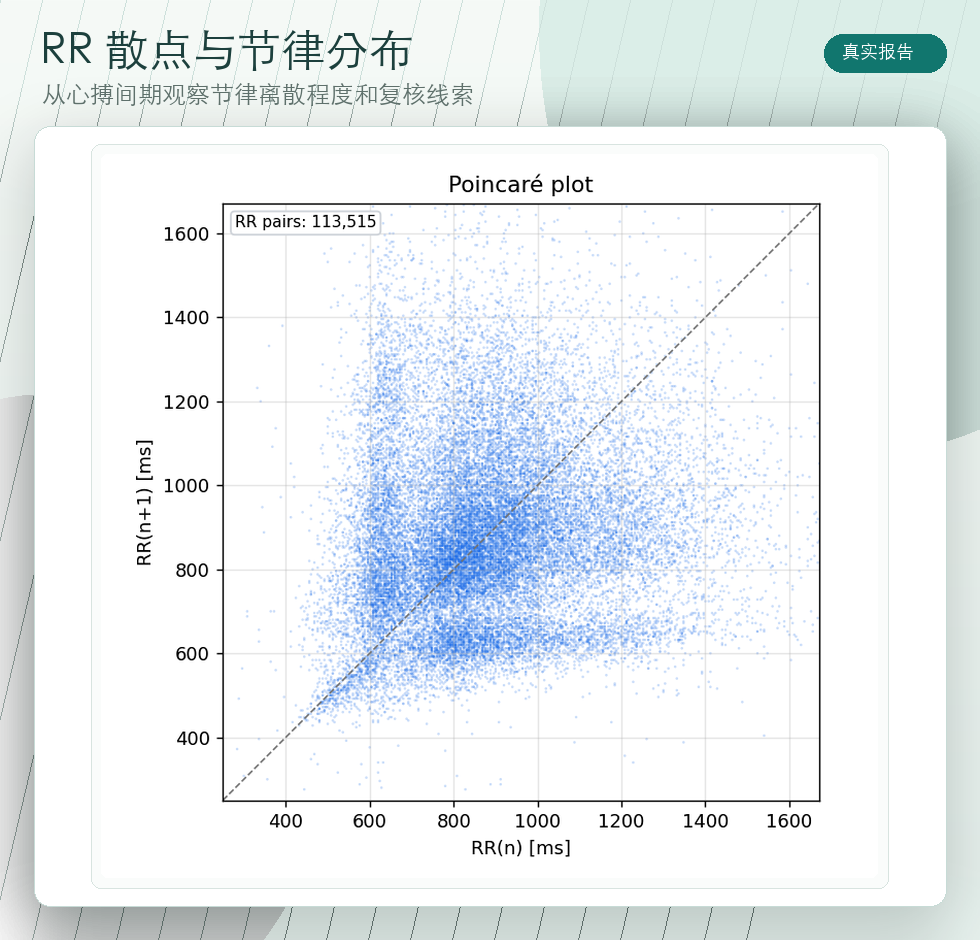 报告中的RR散点图